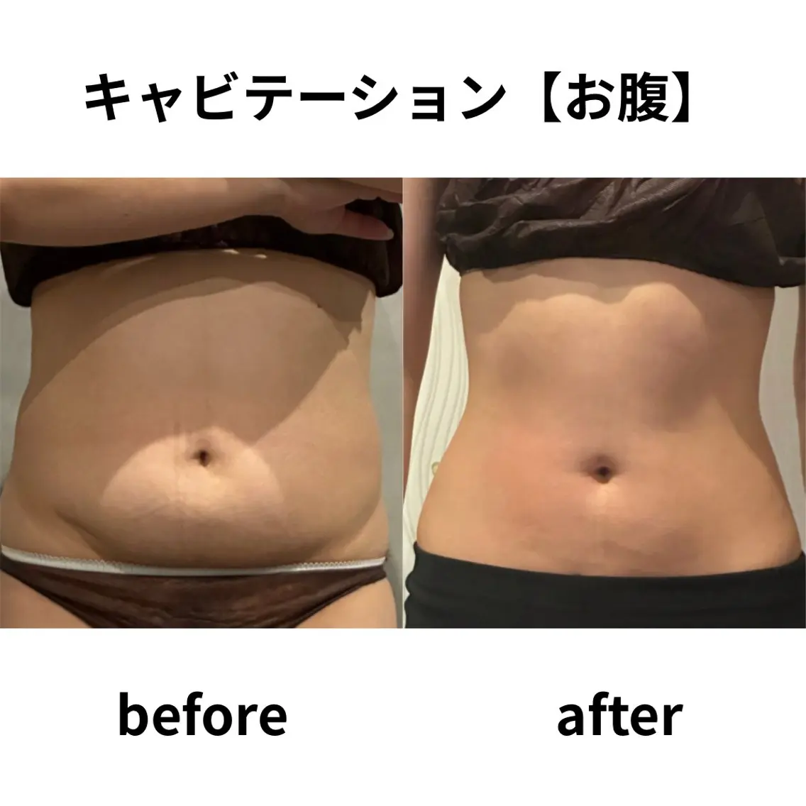 エステ Dahlia痩身脱毛 フェイシャル 中村のエステ・リラクイメージ