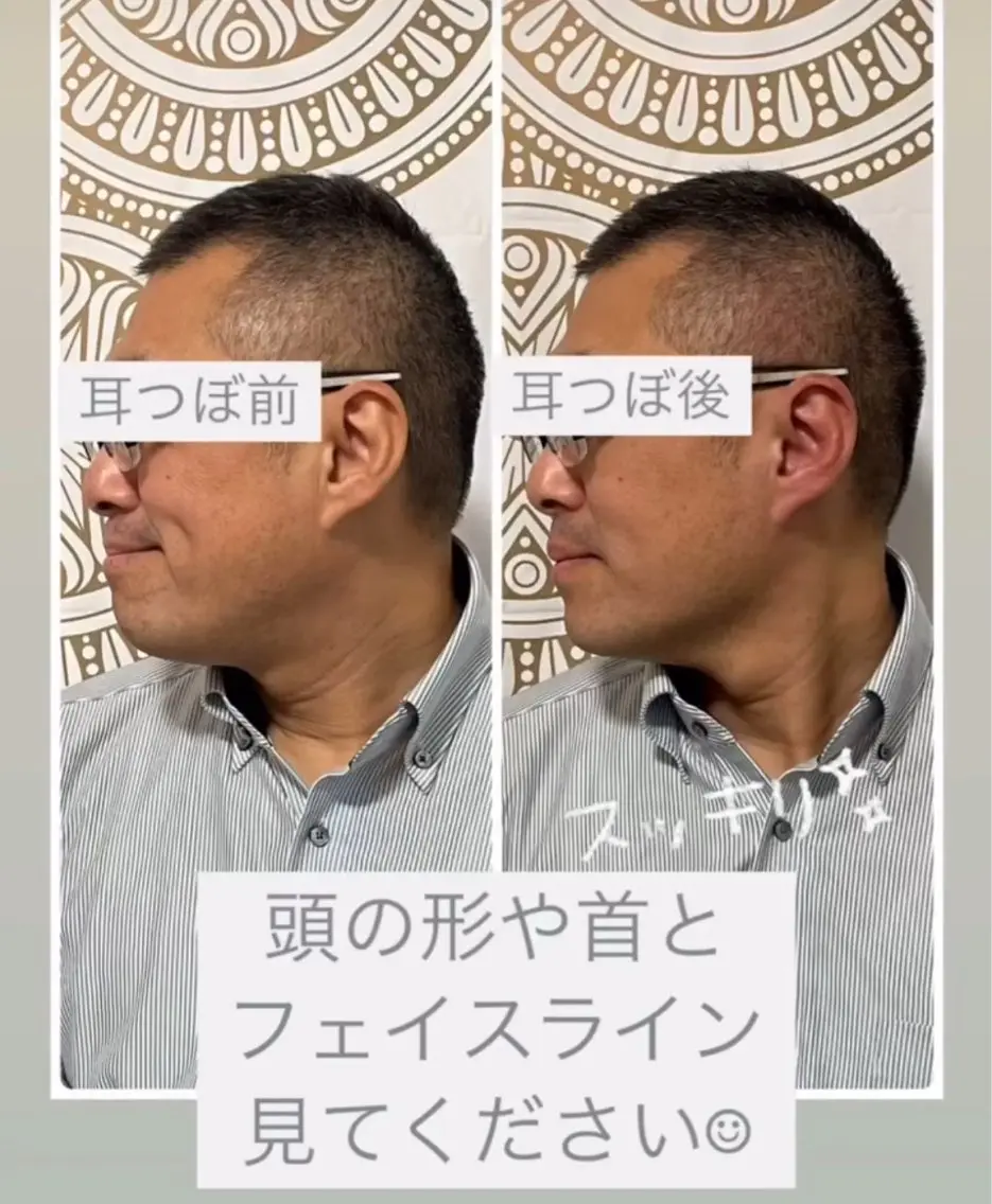 あだち整体エステ 首肩背中のゆるめぐのエステ・リラクイメージ