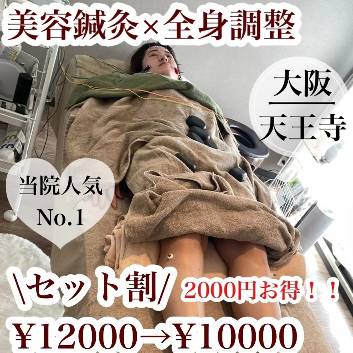 美容鍼灸×鍼灸全身(組み合わせ)の写真