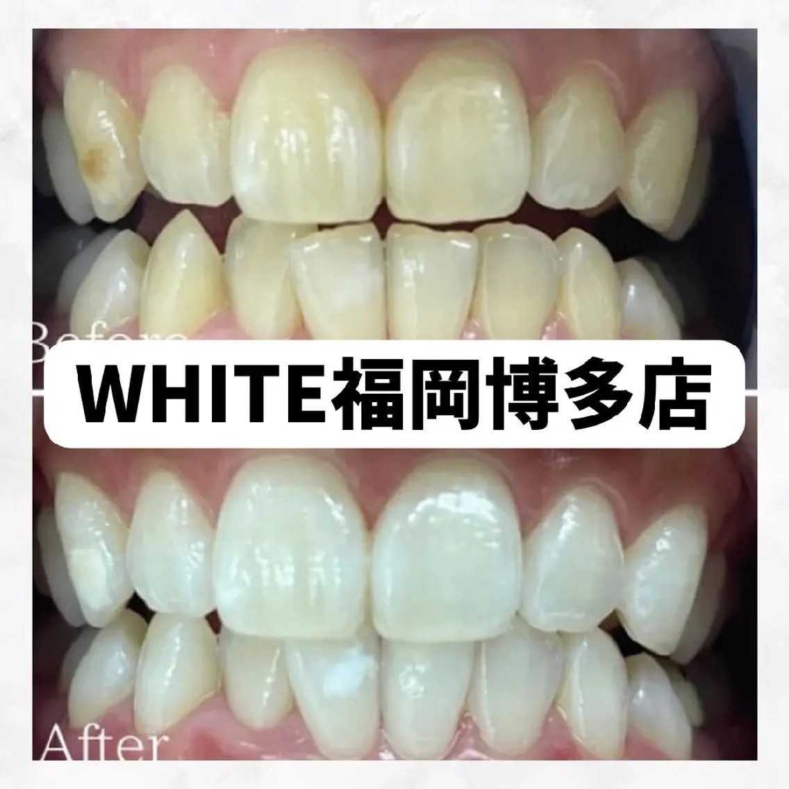 メンズ その他 セルフホワイトニング WHITE福岡博多店のエステ・リラクイメージ