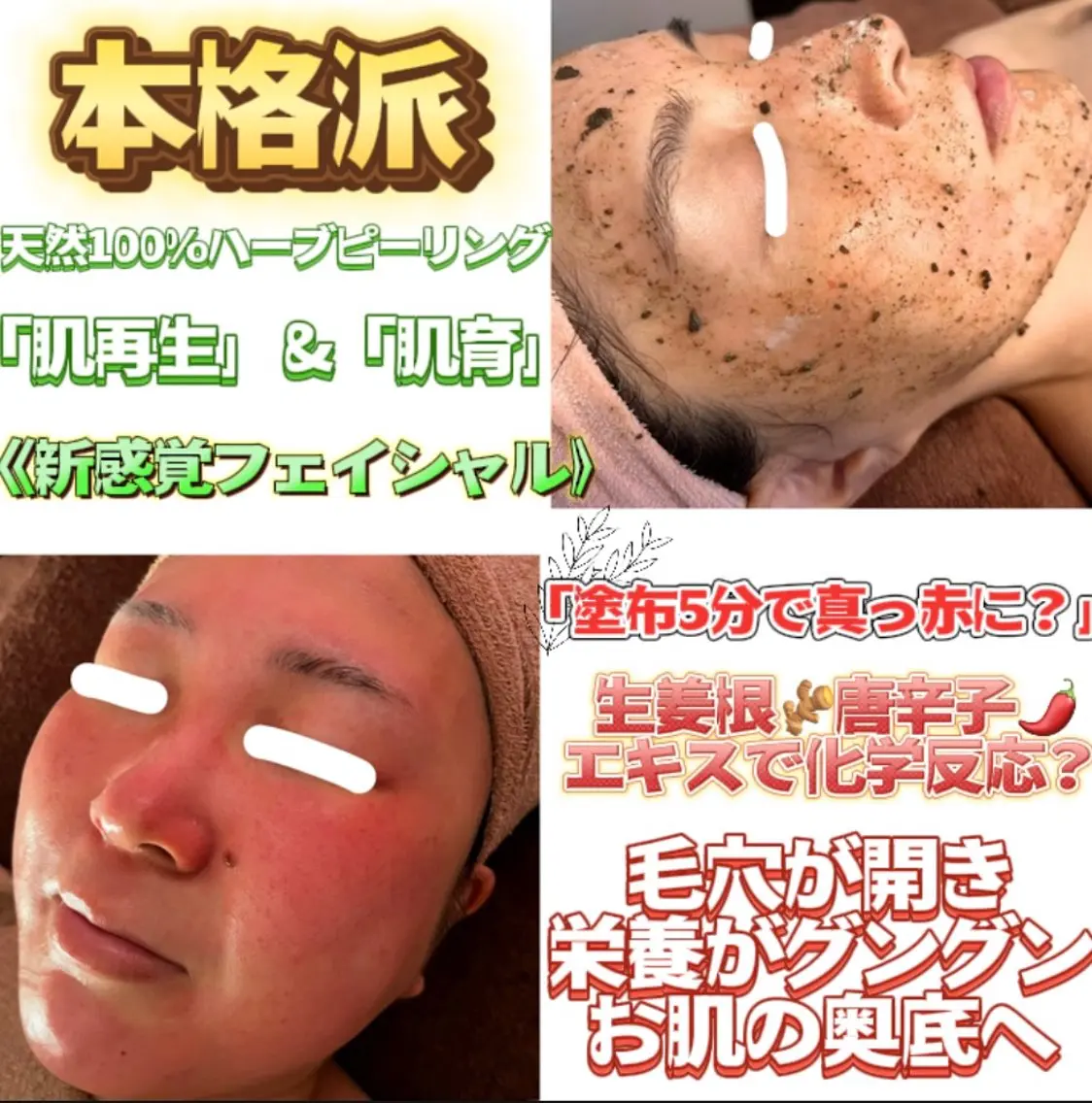 《人気No.1📍》本格派ボンバーハーブピーリングフェイシャル130分の写真