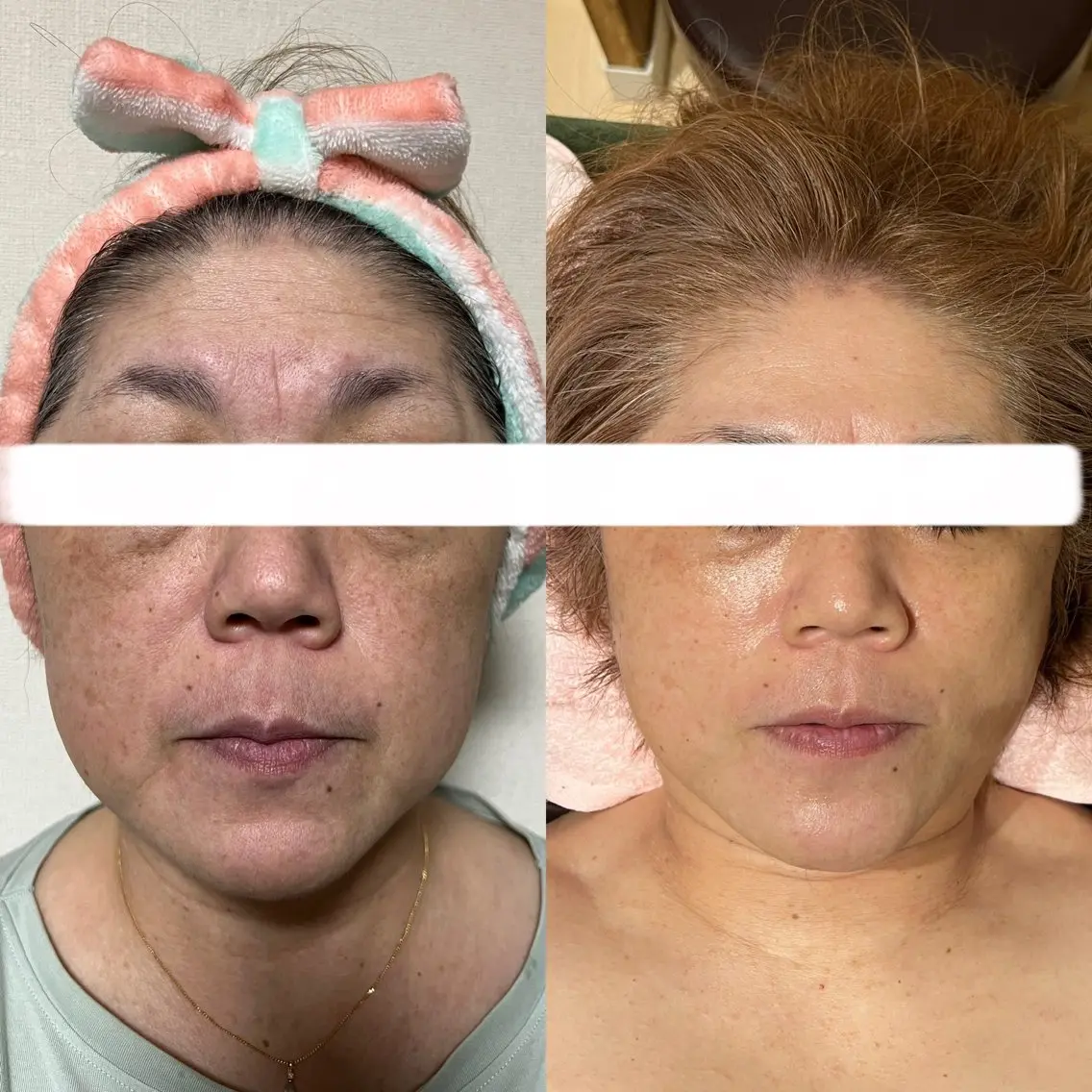 エステ Relaxation SalonARONAのエステ・リラクイメージ