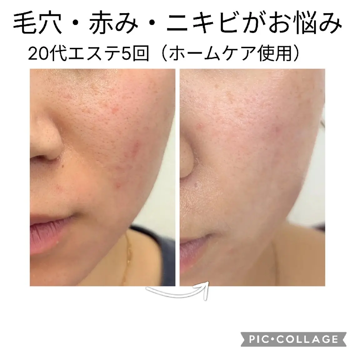 奈良王寺肌改善サロン エミリーノ米田真美子のエステ・リラクイメージ