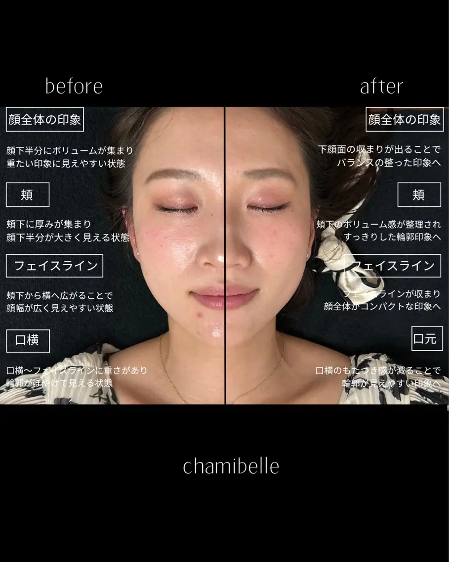 美容鍼灸サロン Chamibelleのエステ・リラクイメージ