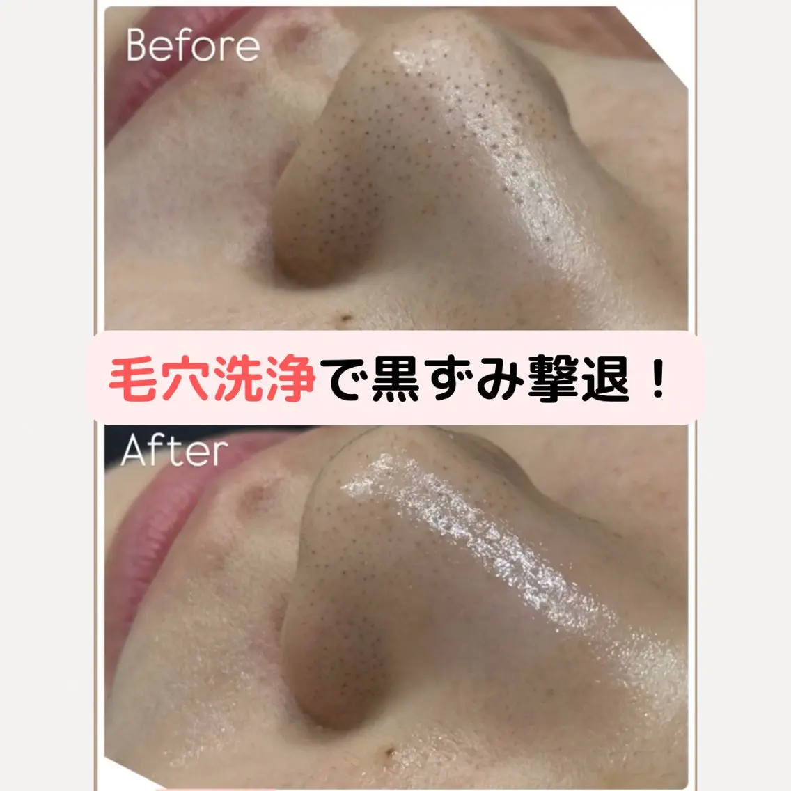 エステ 美肌管理専門Wax/ muroのエステ・リラクイメージ