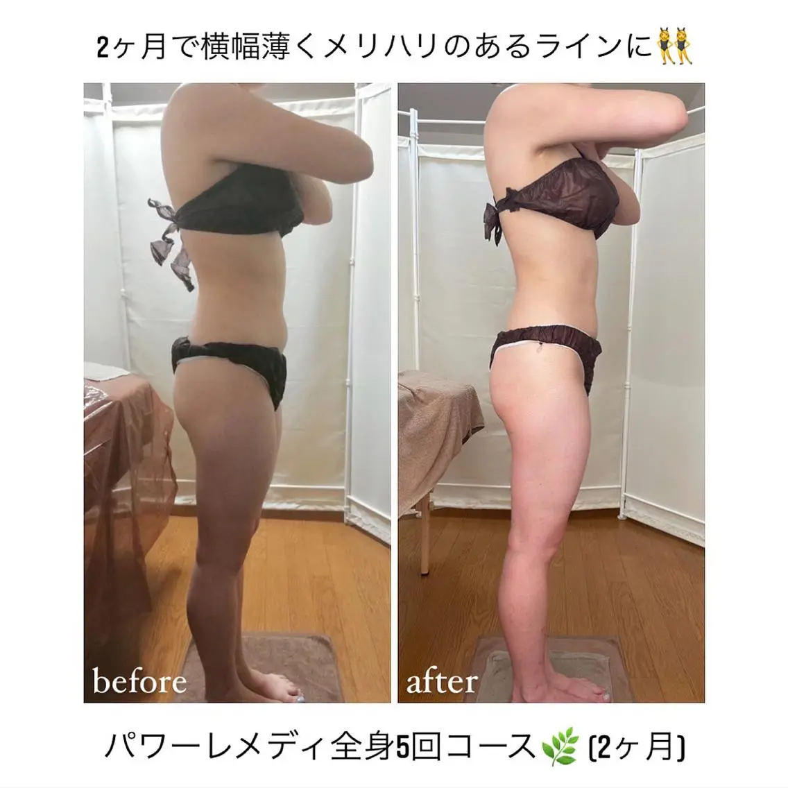 《本気痩せ×疲労改善 》 BILOOPのエステ・リラクイメージ