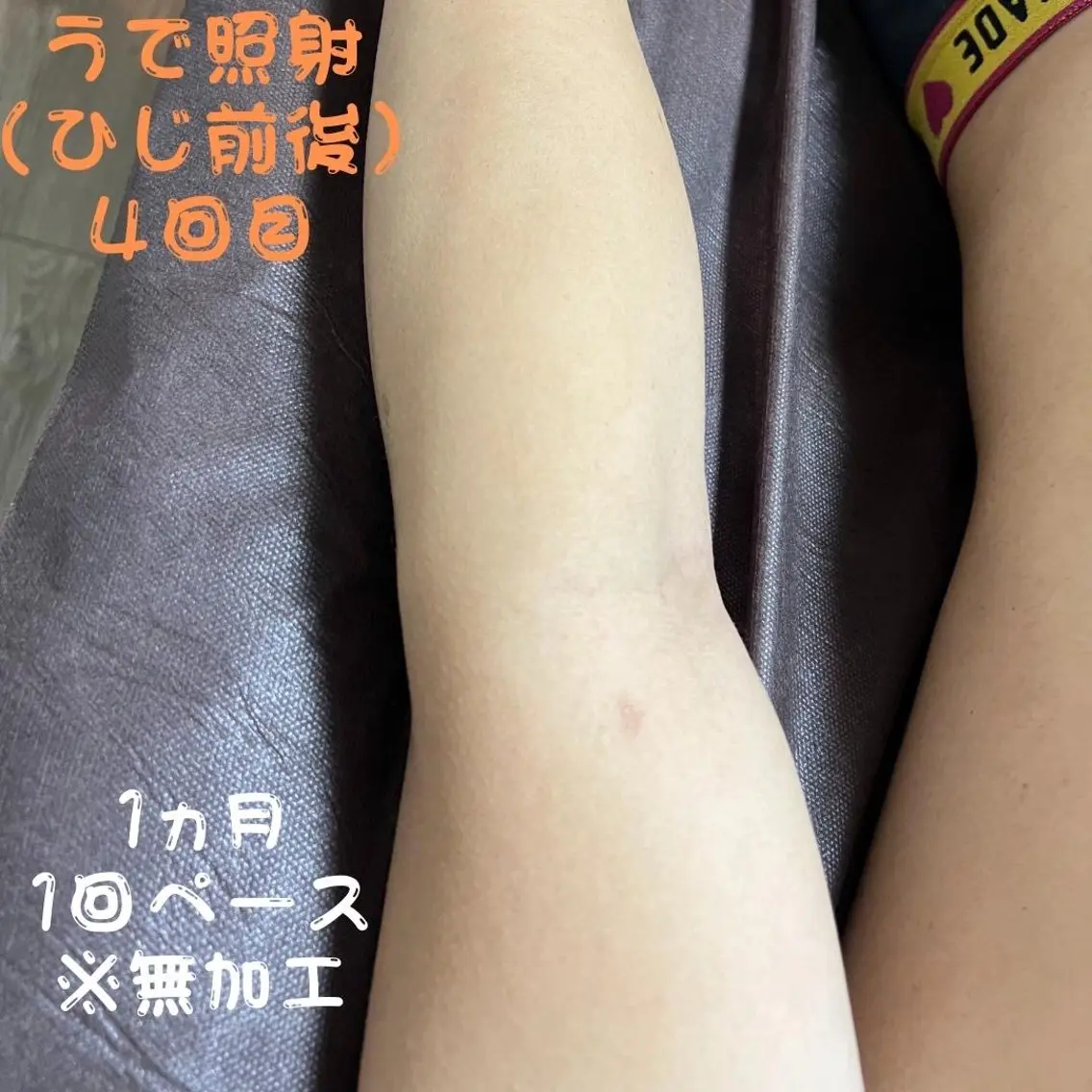 メンズ キッズ 脱毛 メンズ脱毛フェリッセ /男女🆗キッズ🆗のエステ・リラクイメージ