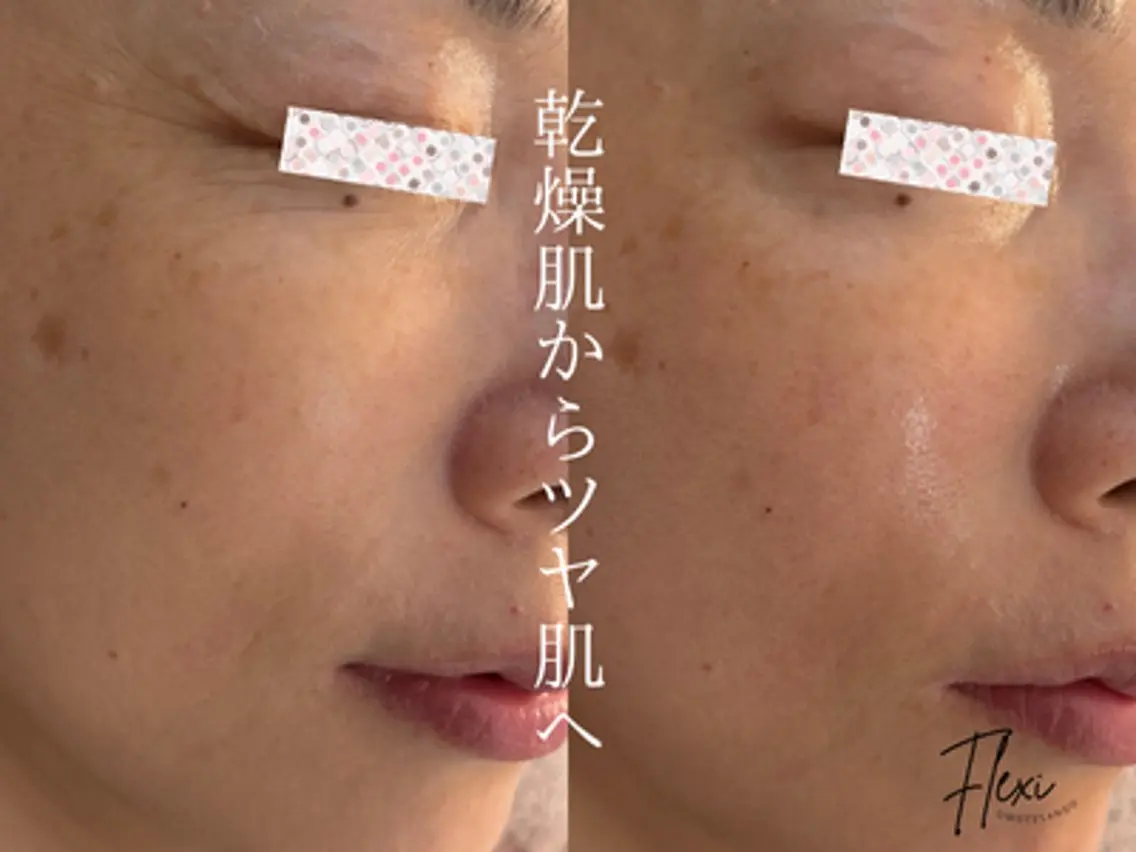 Flexi 表参道のエステ・リラクイメージ