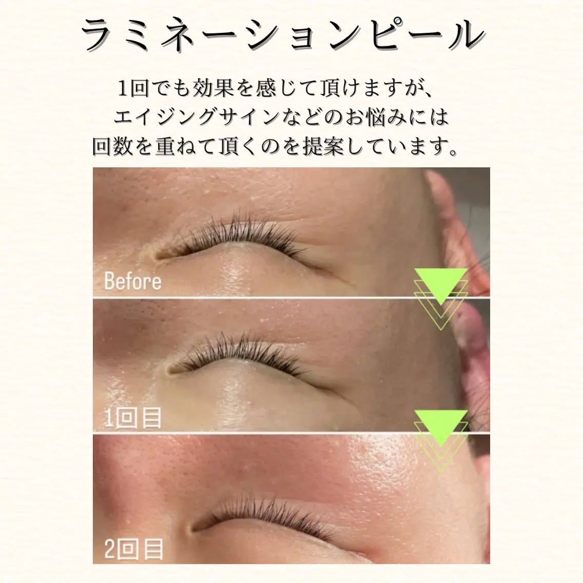 hue. YUKAのエステ・リラクイメージ