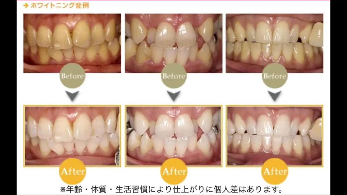 メンズ その他 ホワイトニングサロン nico西葛西店のその他イメージ
