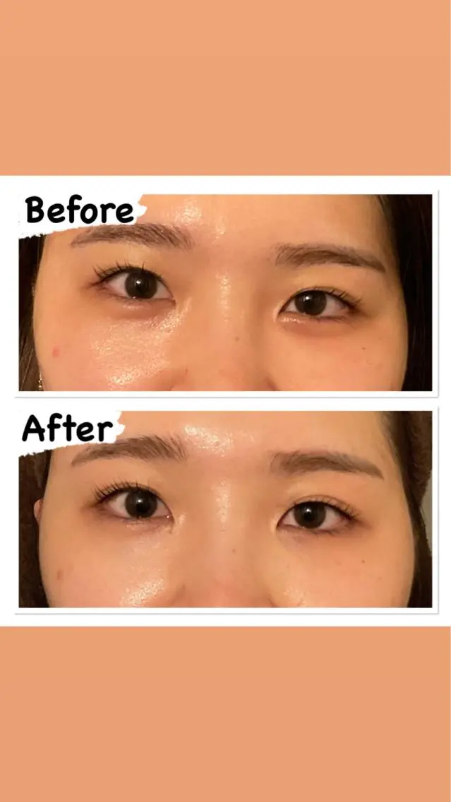 【クマ・むくみ・小顔・美肌】SP全顔ケアコース💆🏼‍♀️の写真