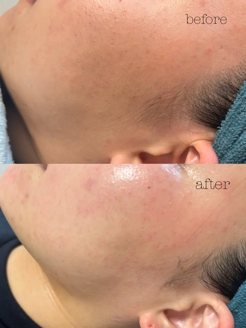 脱毛 SALON MAREのネイルデザイン