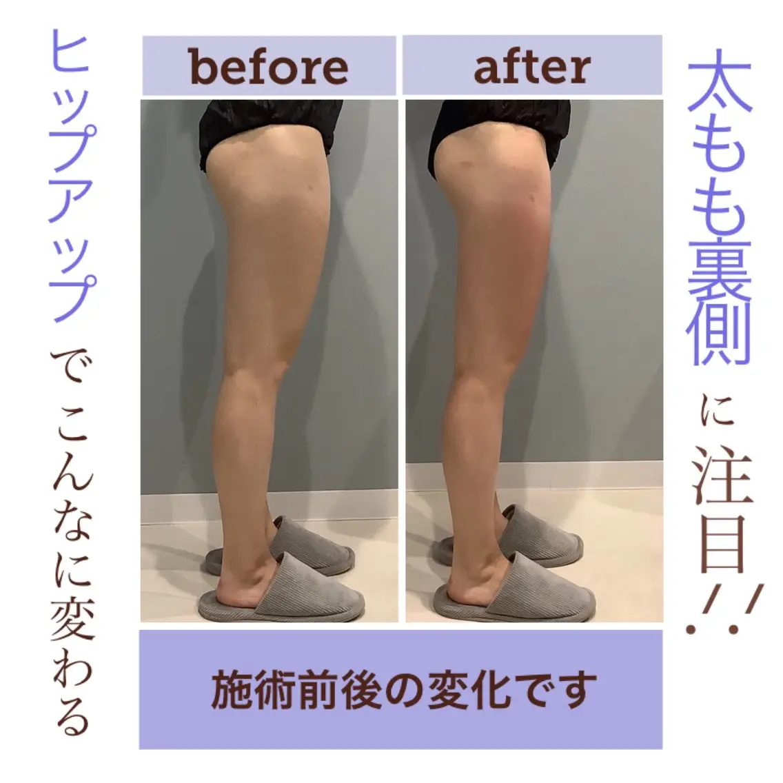 エステ エステサロン JURISのエステ・リラクイメージ