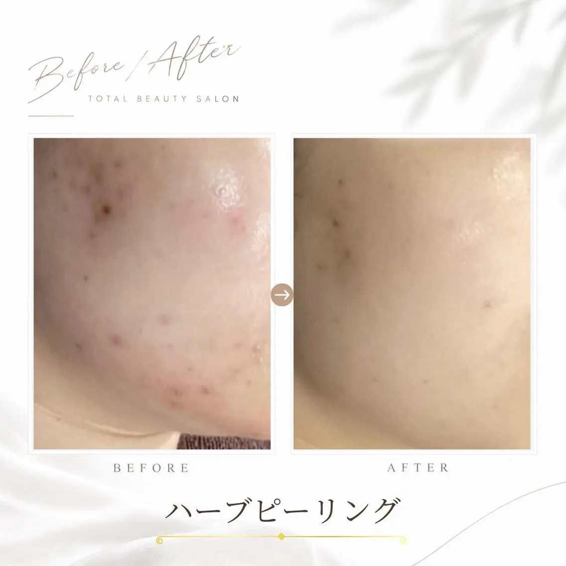 《 肌質×美肌 》 addissimoのエステ・リラクイメージ