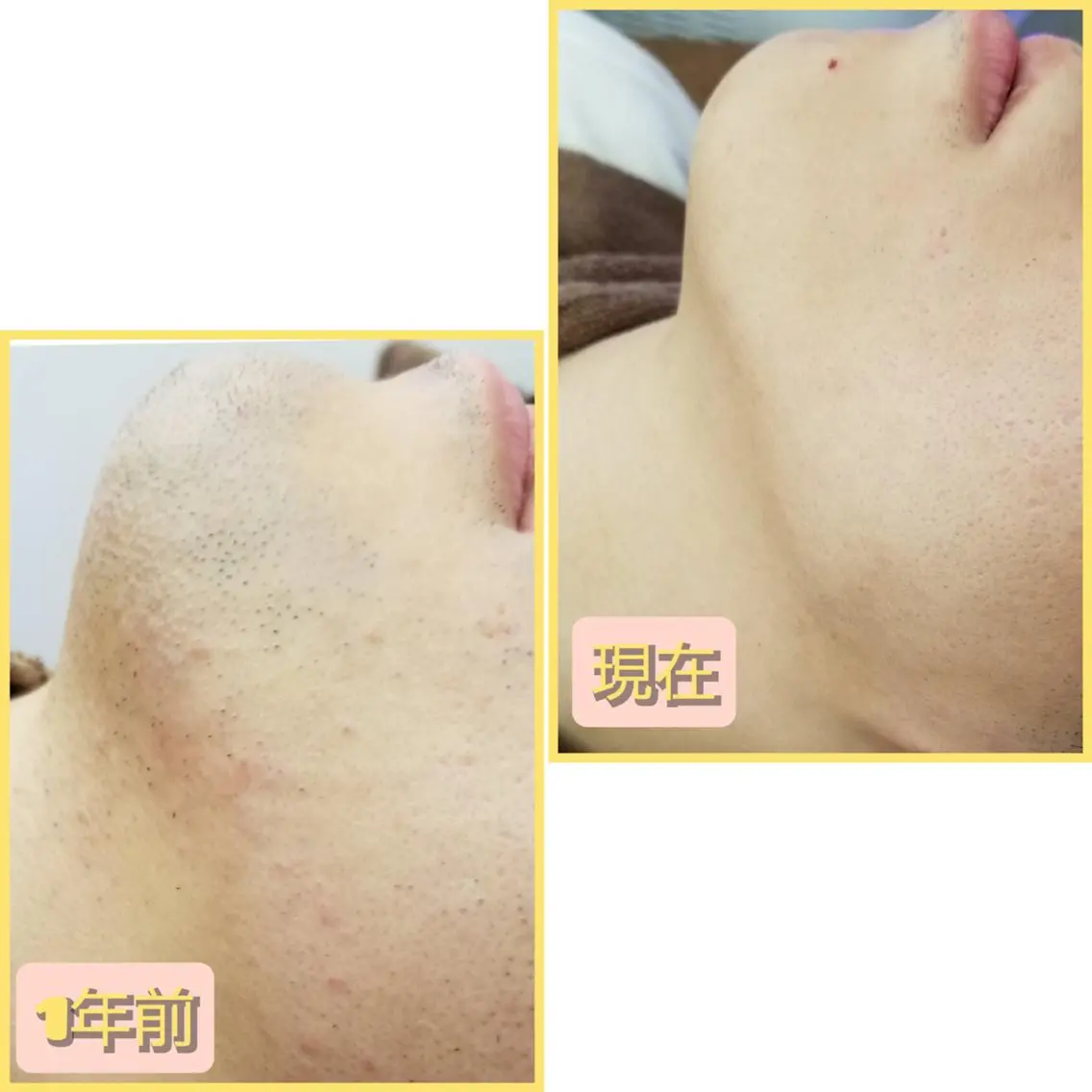 メンズ 脱毛 salonde ReGodのエステ・リラクイメージ