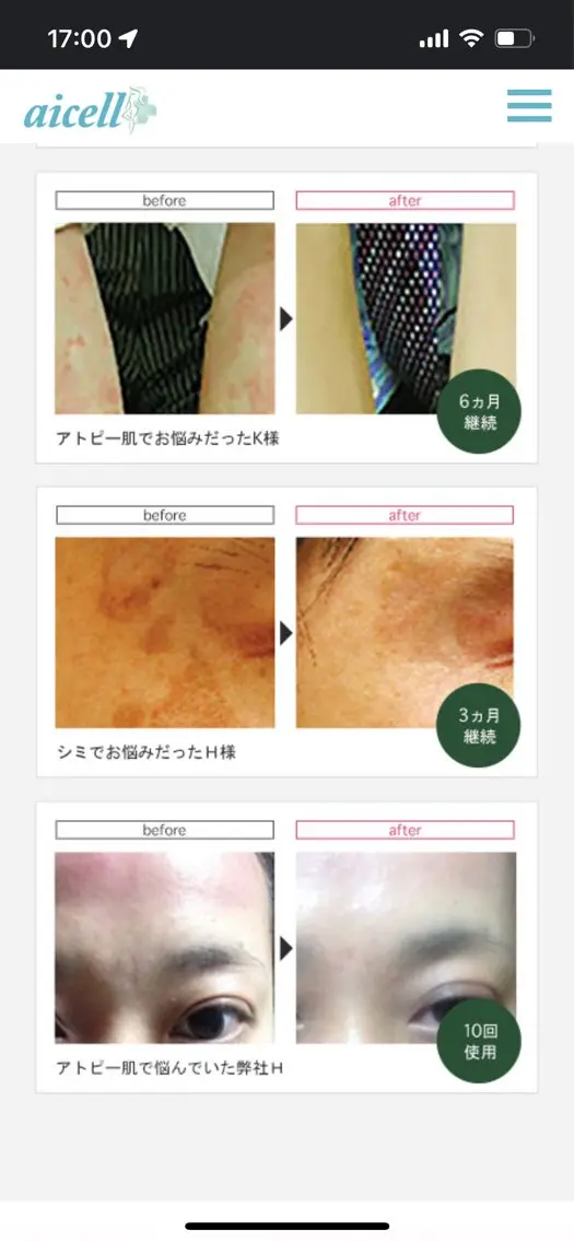 肌質改善 ルポエトワのエステ・リラクイメージ