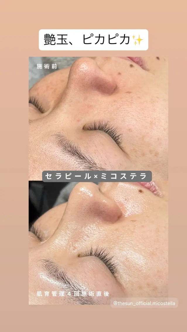 その他 cocofleur 美容看護師監修サロンのエステ・リラクイメージ