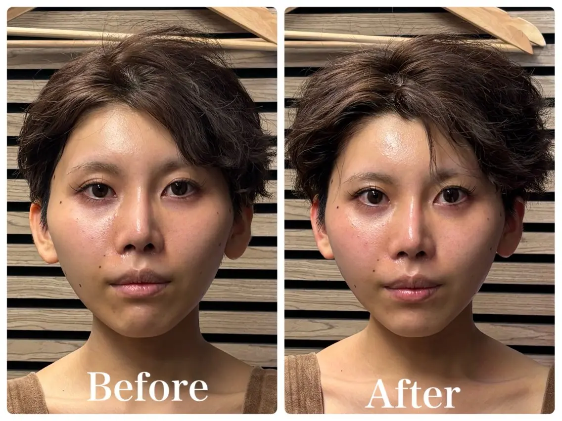 エステ 💎小顔サロン アリリン銀座💎のエステ・リラクイメージ