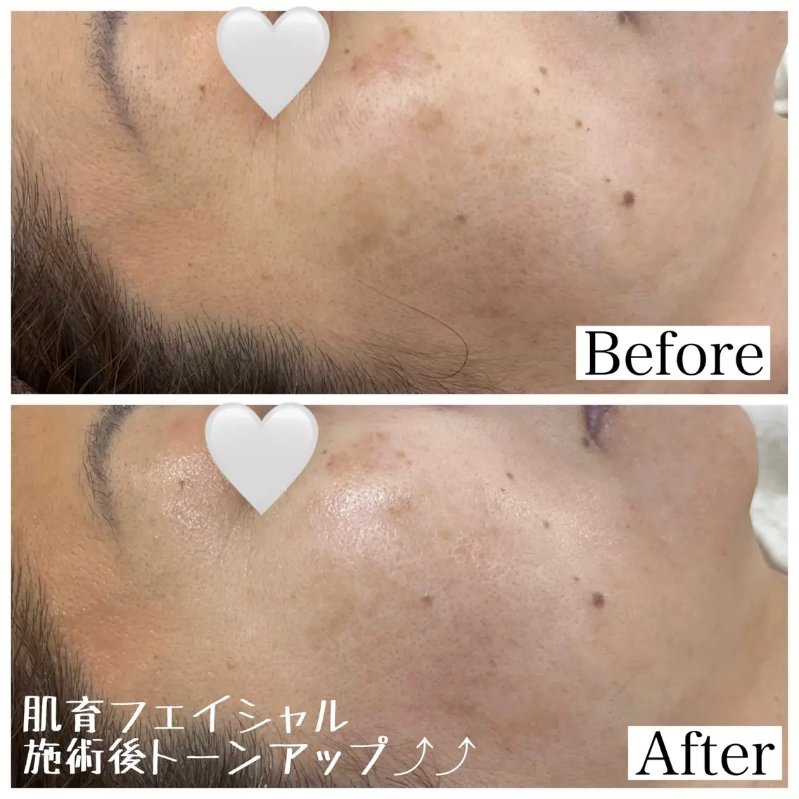【脱毛と肌育のお店】 sharan✨✨のエステ・リラクイメージ