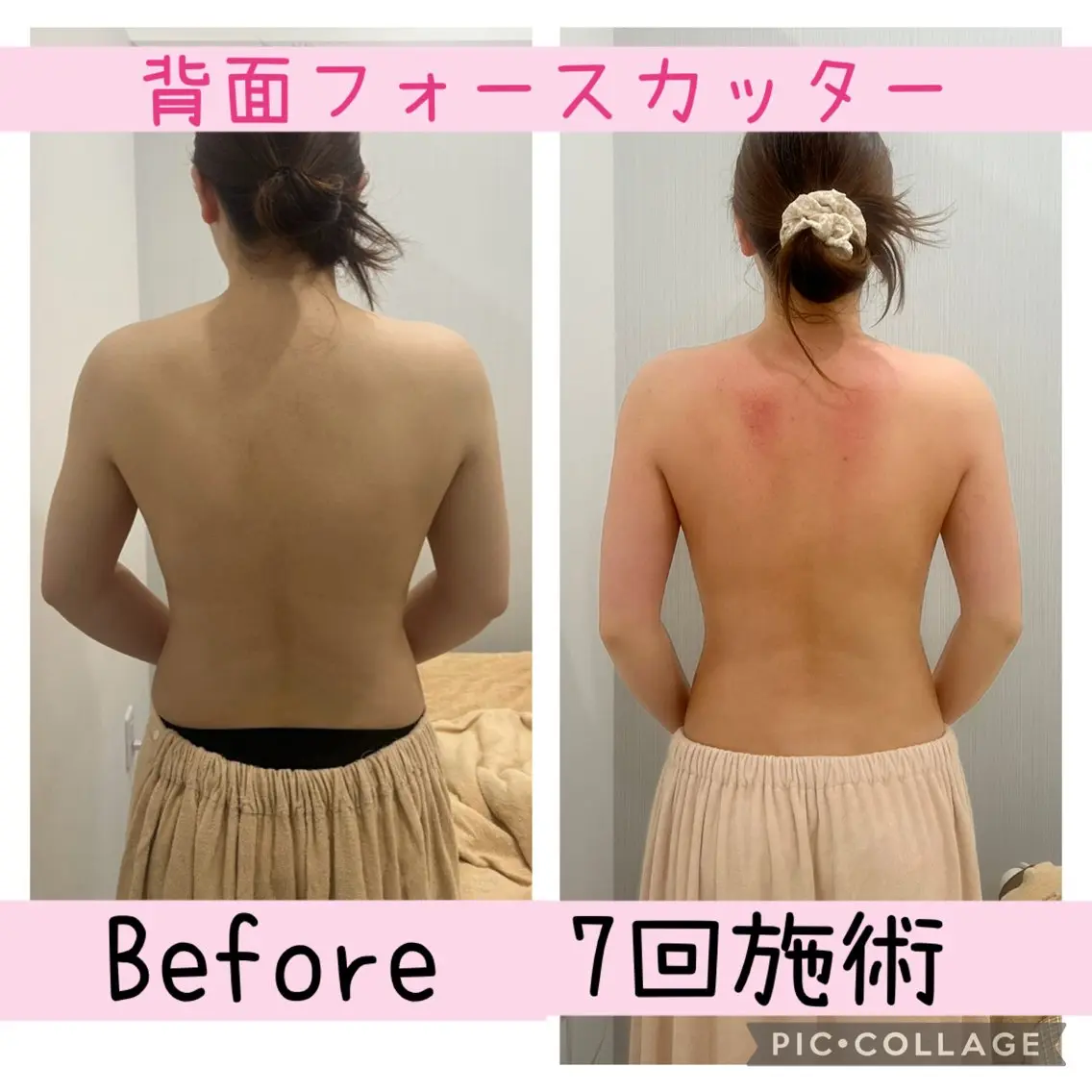 ブライダル痩身×脱毛 尼崎駅前サロンのエステ・リラクイメージ