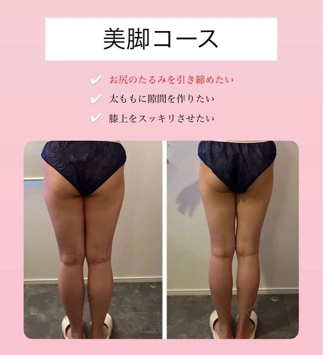 その他 Raviy 【痩身専門・肌管理】のエステ・リラクイメージ