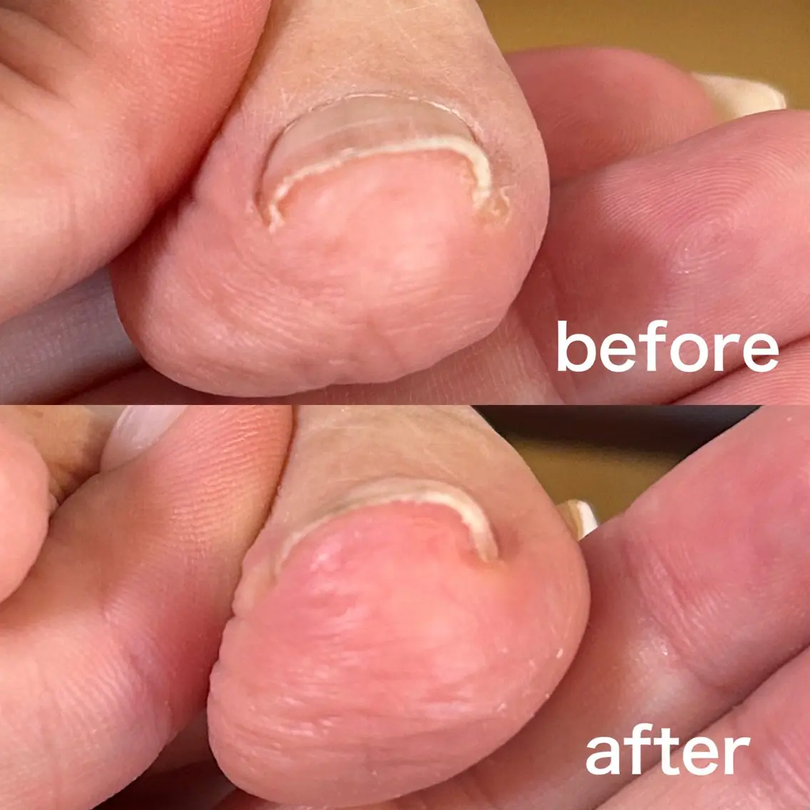 ネイル フットネイル 整うネイルサロン RIN NAILのネイルデザイン