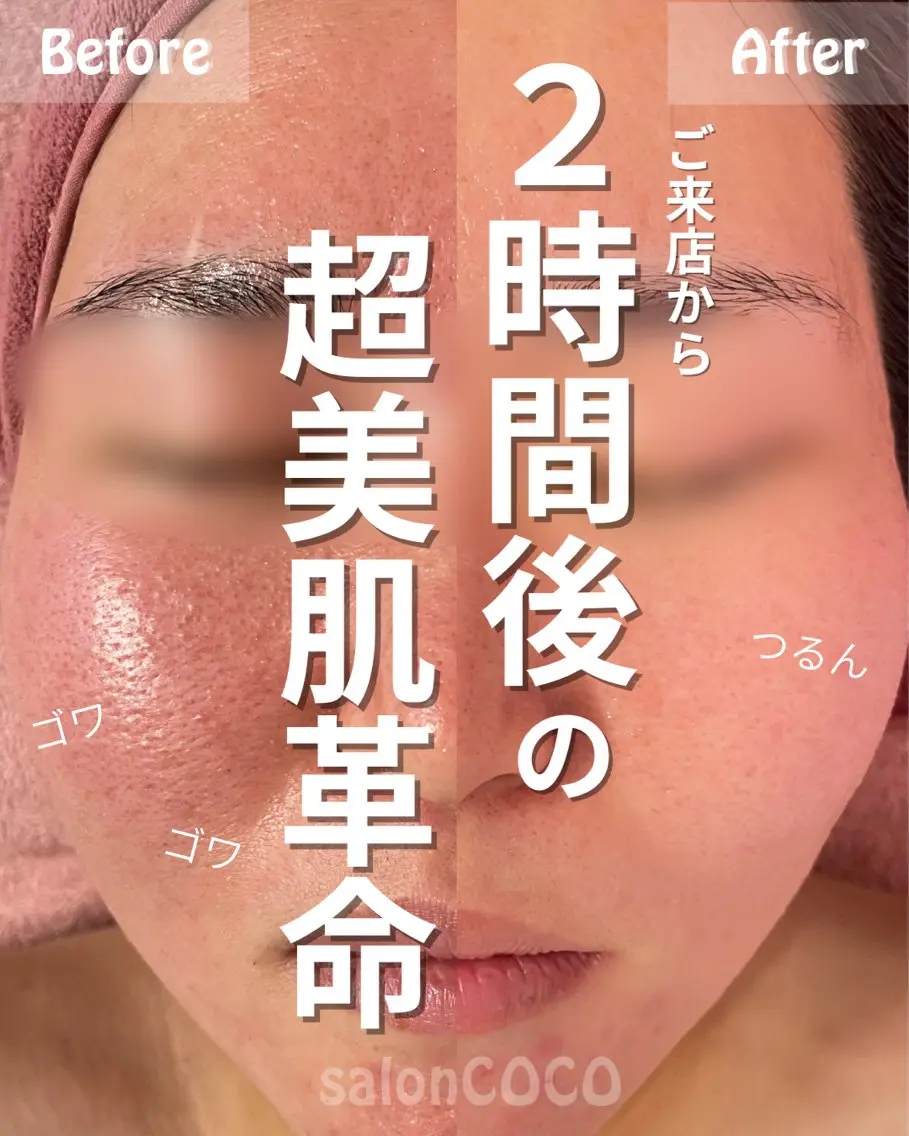 エステ リラク 素肌再建看護師💎 salonCOCOのエステ・リラクイメージ