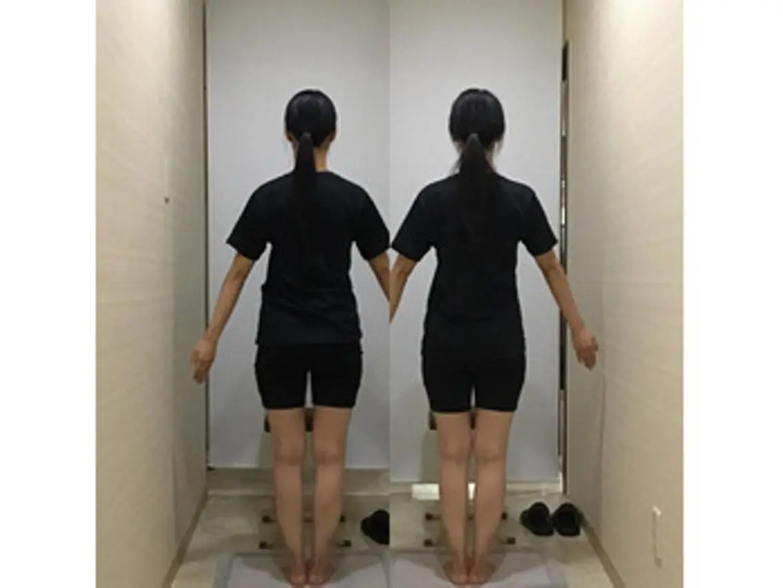 姿勢・骨盤/小顔矯正 痩身ダイエット 横田のエステ・リラクイメージ