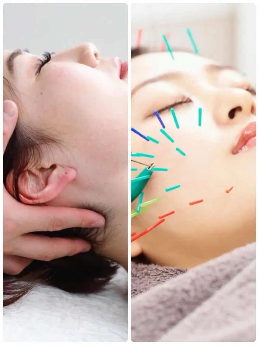 【女性人気No.1】美容鍼灸+小顔矯正のセットプラン⭐️の写真