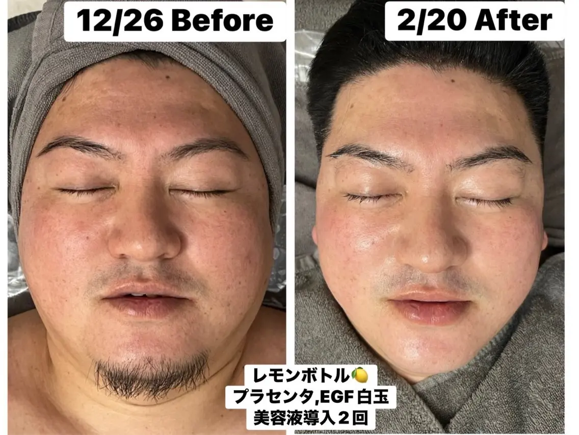 SALON DE GiGiのエステ・リラクイメージ