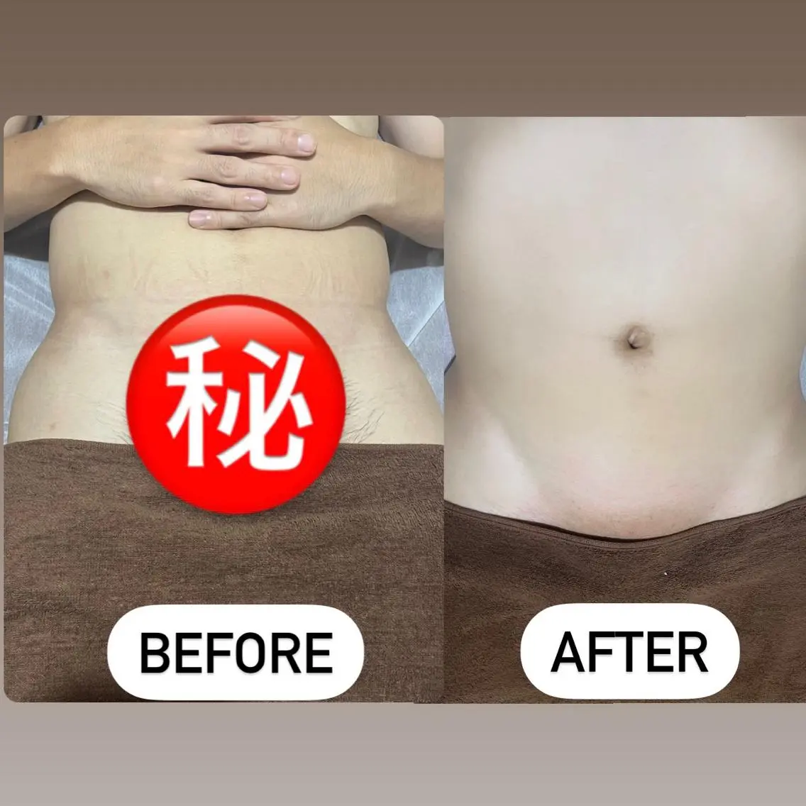 ✨ミニモ限定価格✨メンズ ブラジリアンワックス  VIO  WAX脱毛 鎮静クリーム付き ¥5500の写真
