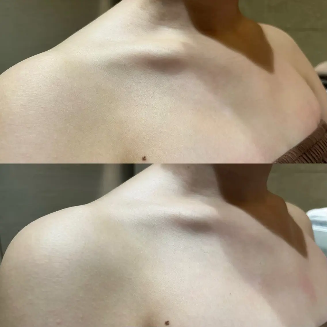 デコルテシェービング🫧✨の写真