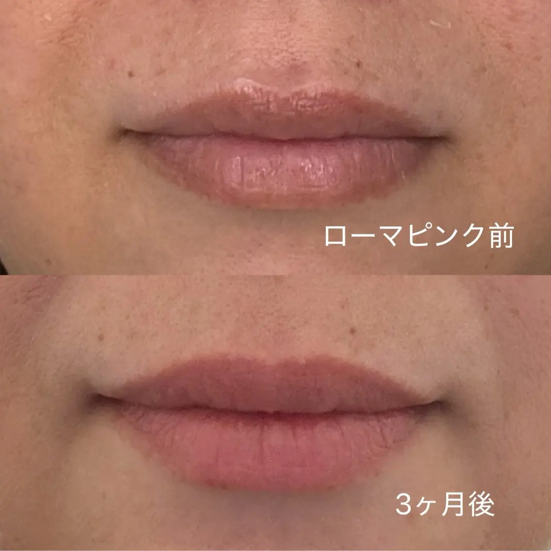 エステ 肌質改善サロン and...のエステ・リラクイメージ