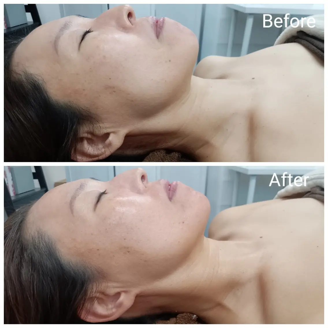 肌質改善Beauty salon Renのエステ・リラクイメージ