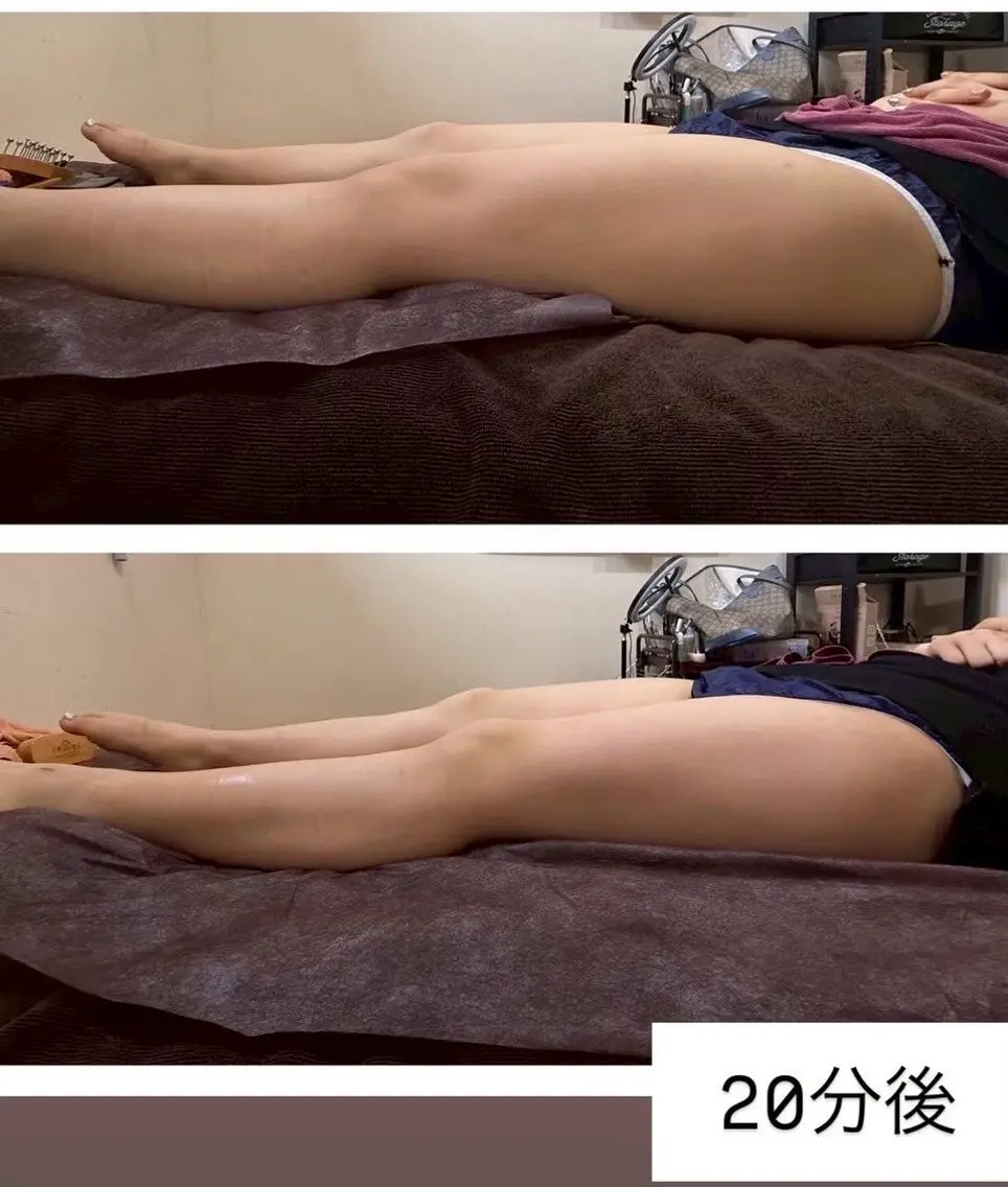 🎗️足やせ専科🎗️美脚45分コース パンパンな足をスペシャルカッサでほぐし流すことで、体液循環を促します🔄の写真