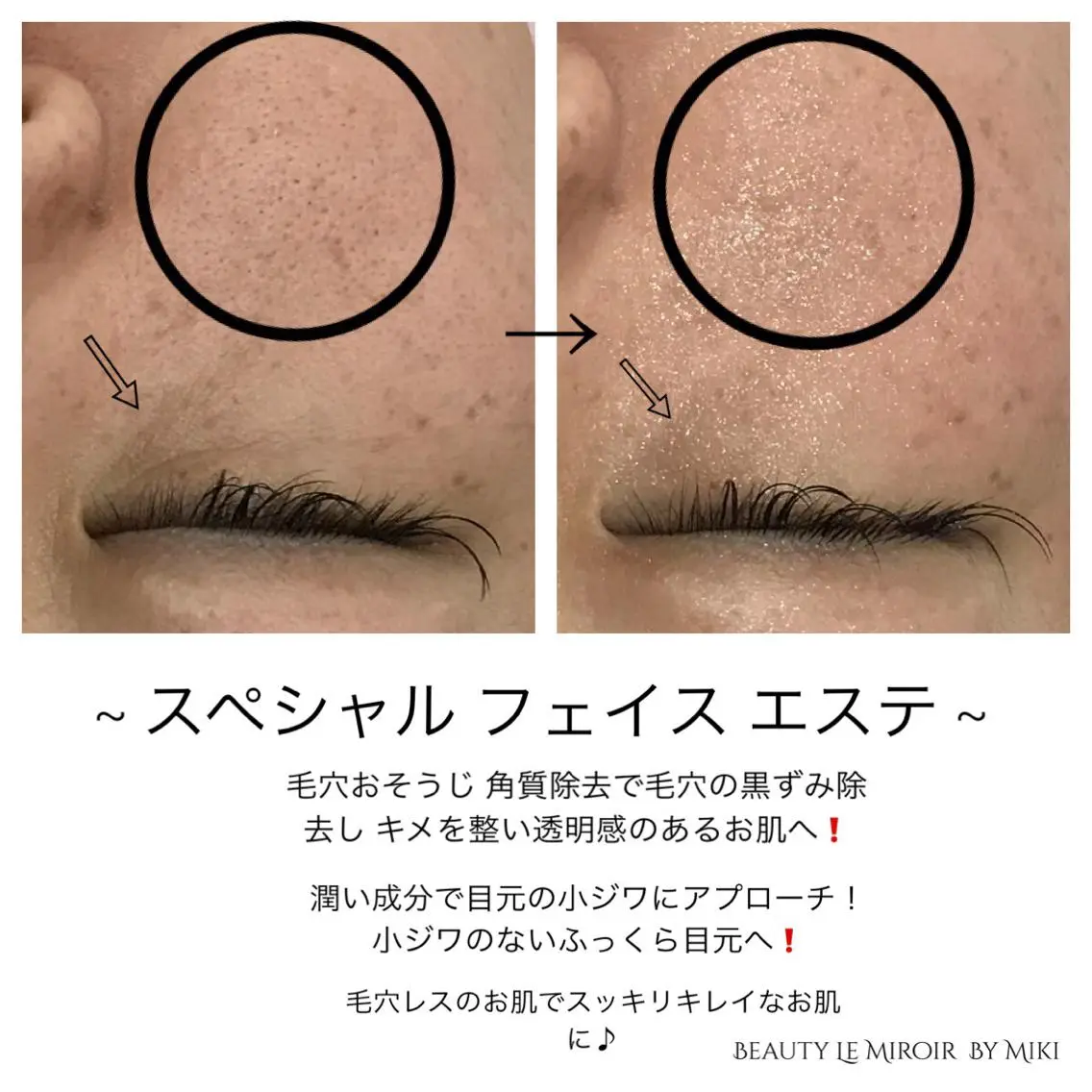ビューティー ミロワールのエステ・リラクイメージ