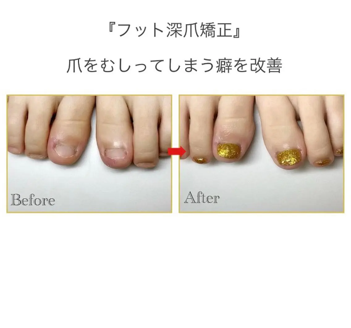 ネイル フットネイル ネイルサロン アリュームのネイルデザイン