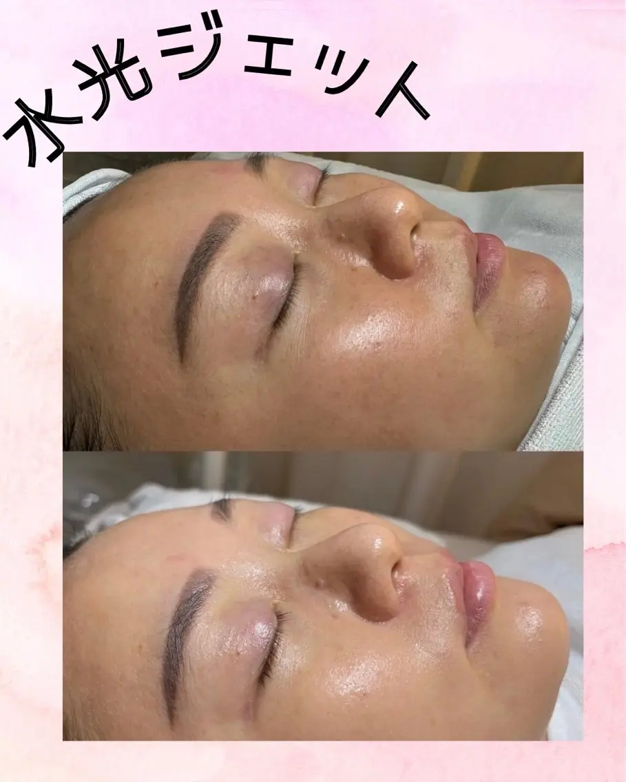 マツエク・マツパ aliaハーブ水光店 エステティシャン募集のエステ・リラクイメージ
