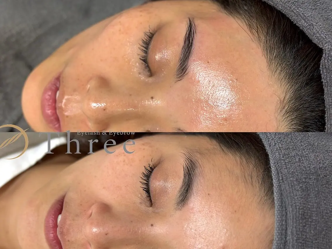 ⭐️【新規/お写真OKの方/現金支払い(万券NG)】フェイスWAX脱毛(眉のデザインは含まれていません)鎮静パック付⭐️の写真