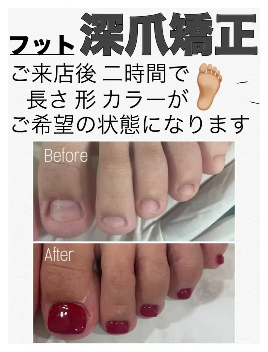 ネイル フットネイル nail salon petillantのネイルデザイン