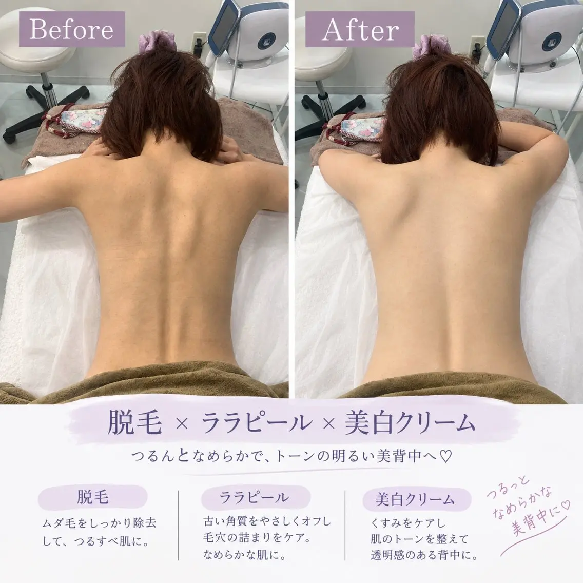 マツエク・マツパ エステ 愛維美水光美肌専門店 メンズレディースokのエステ・リラクイメージ