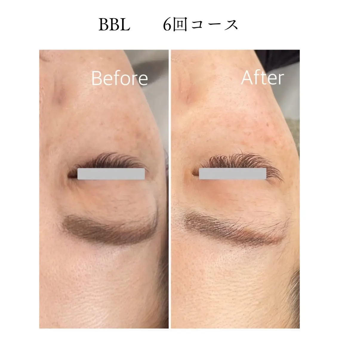 エステ TiALASH Estheticのエステ・リラクイメージ