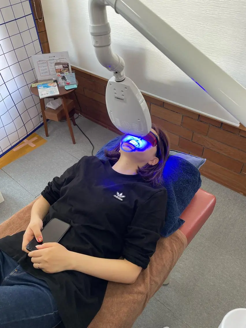🦷セルフホワイトニング🦷限定10名様の写真