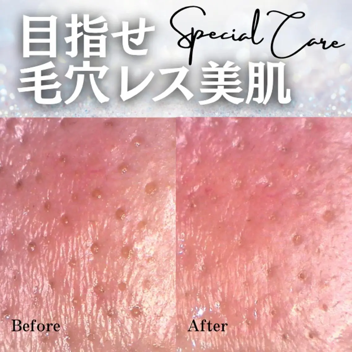 20代メンズのためのお手入れ/徹底皮脂対策！皮脂詰まり、黒ずみ、乾燥の写真