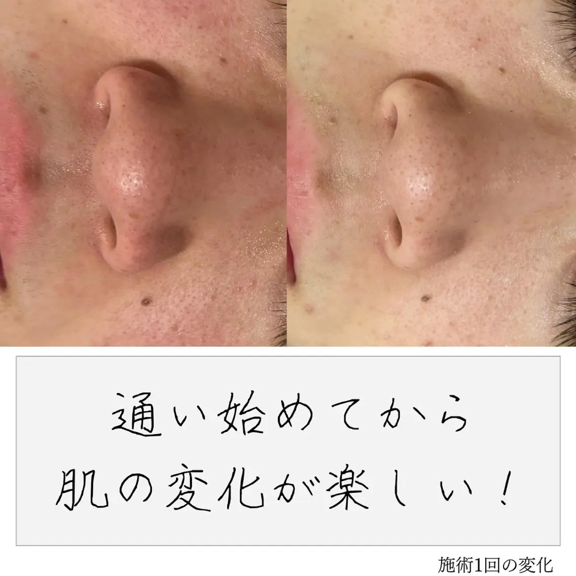 ニキビ経験者が施術 する専門サロン🌻のエステ・リラクイメージ