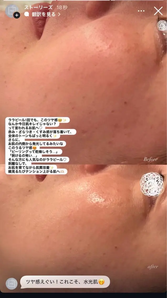 エステ Smoo アユミの眉毛・アイブロウイメージ