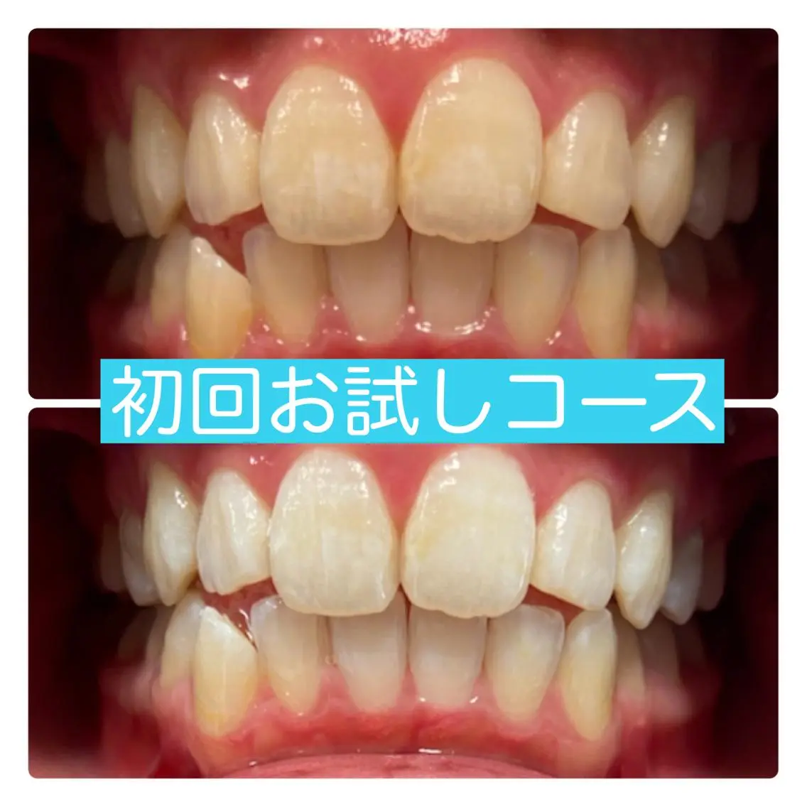 ホワイトニングルーム 横浜店のその他イメージ