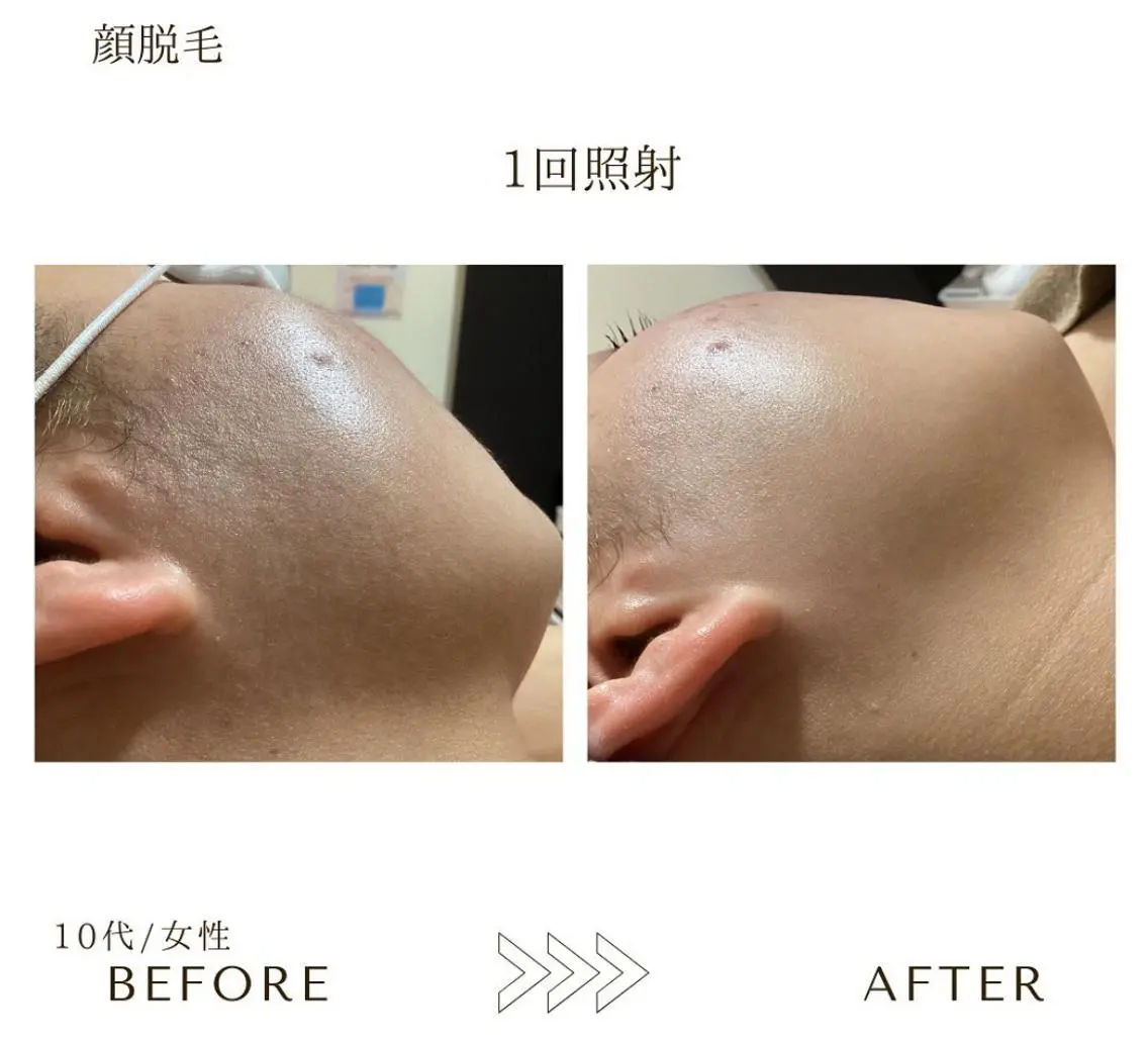 脱毛 本八幡salon83 ♡エイトミーのエステ・リラクイメージ