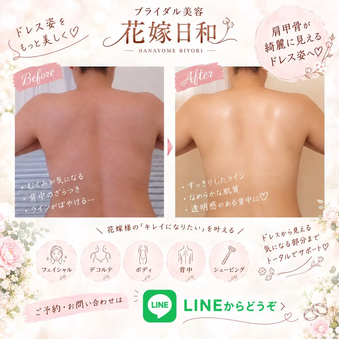 ブライダル美容 花嫁日和のエステ・リラクイメージ