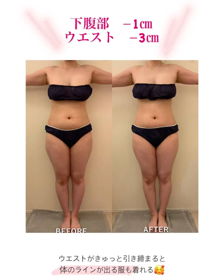 産後ダイエット−9㎏ Pourvous結衣のエステ・リラクイメージ